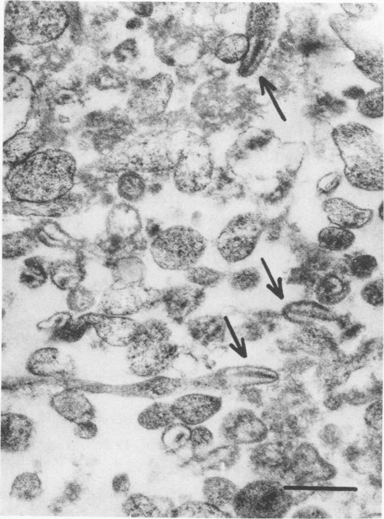 graphic file with name iai00186-0321-a.jpg