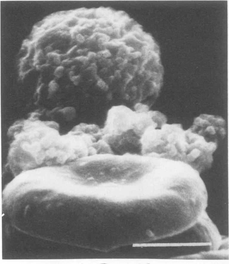 graphic file with name iai00186-0320-d.jpg