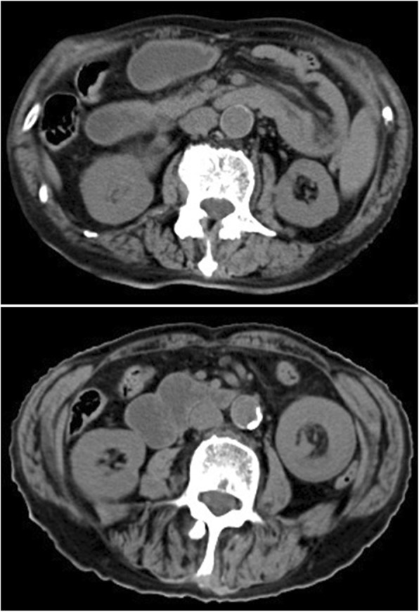 Fig. 2