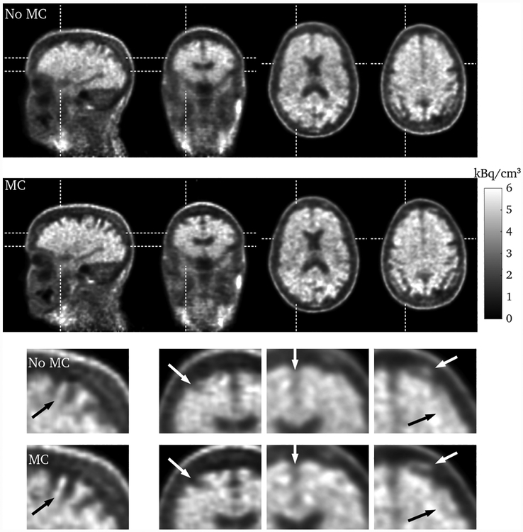 Fig. 10.