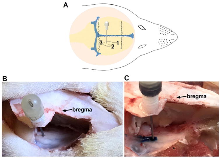 Fig 3