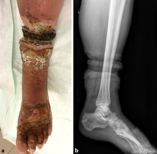 graphic file with name 113_2020_951_Fig1_HTML.jpg