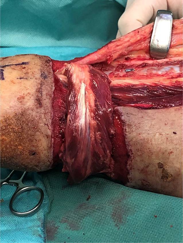 graphic file with name 113_2020_951_Fig3_HTML.jpg