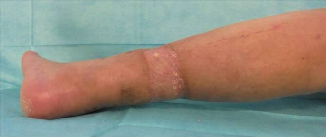 graphic file with name 113_2020_951_Fig5_HTML.jpg