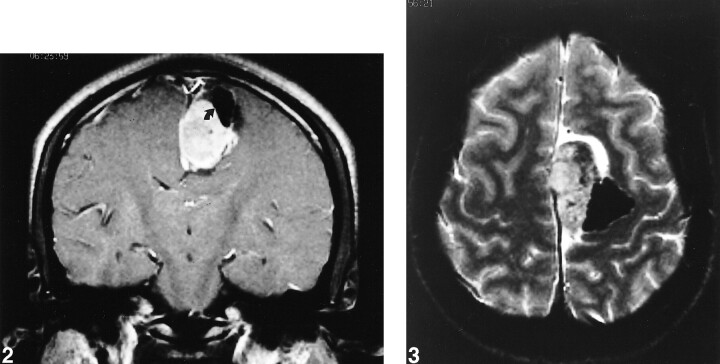 fig 2.