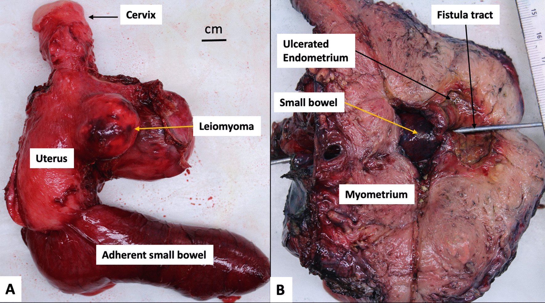 Fig. 4