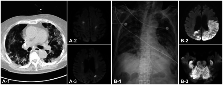 Fig. 1