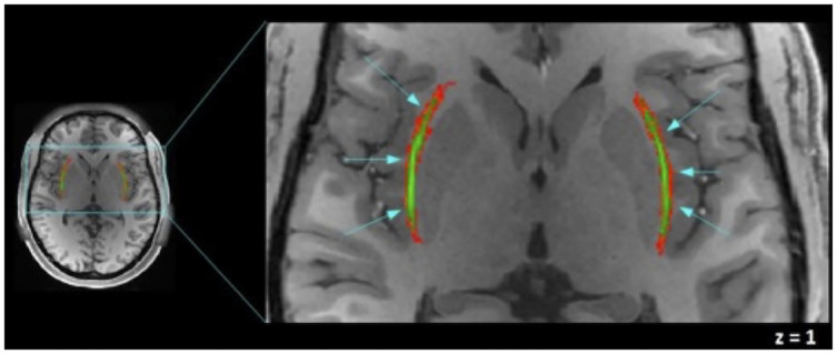 Fig 2