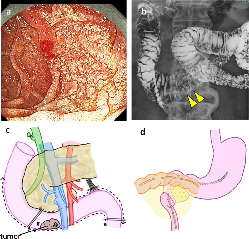 Fig. 4