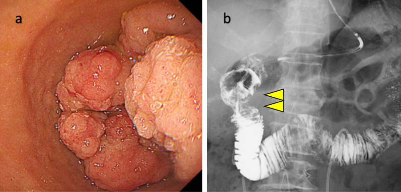 Fig. 1