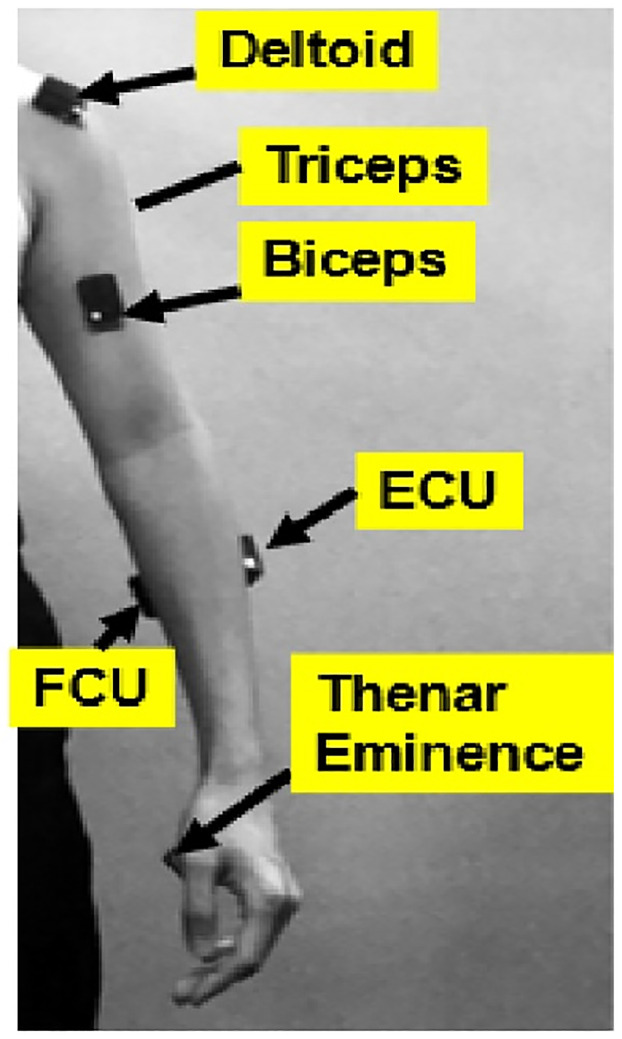 Fig 1