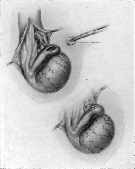 Fig. 10