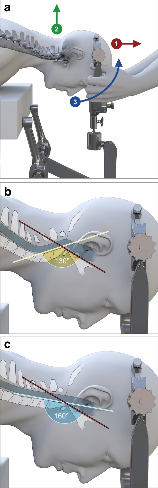 Fig. 3