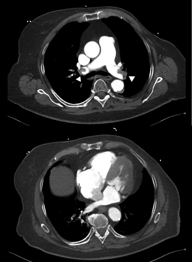 Figure 2