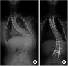 Fig. 18