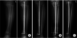 Fig. 13