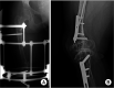 Fig. 16