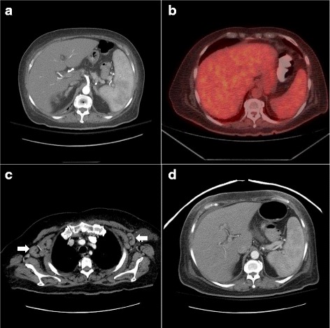 Fig. 1