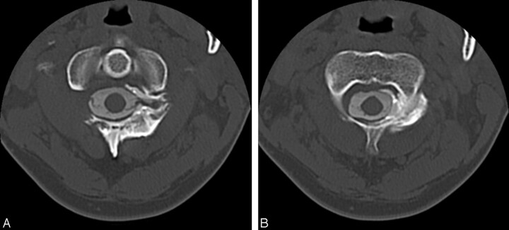 Fig 3.