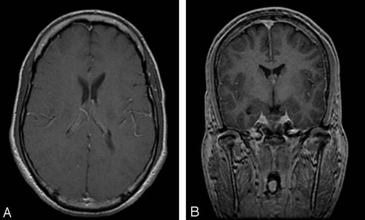 Fig 6.