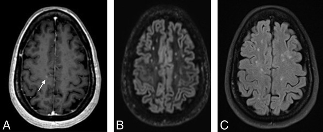 Fig 1.