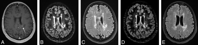 Fig 2.