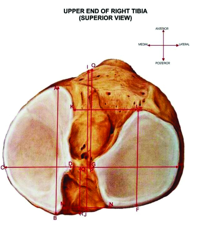 [Table/Fig-2]: