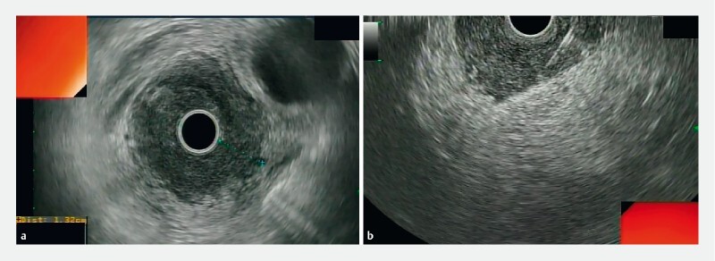 Fig. 1 