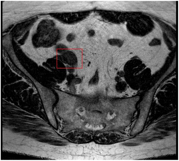 Figure 1c