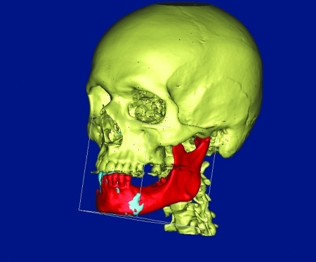 Figure 19