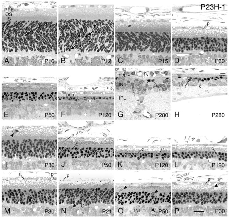 Figure 17