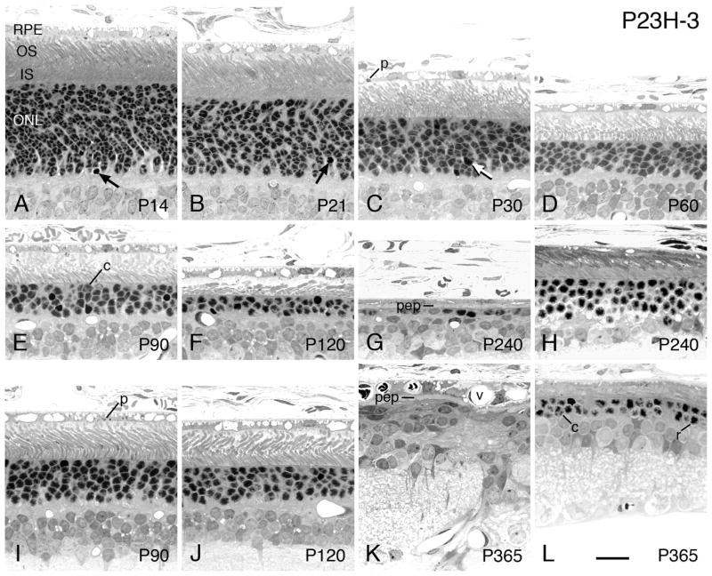 Figure 18