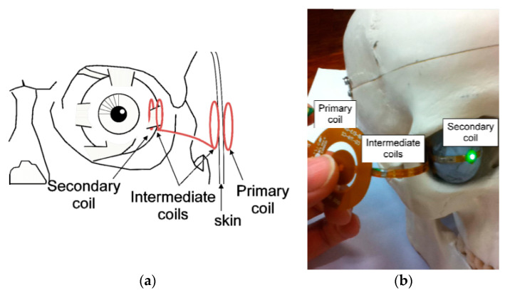 Figure 26