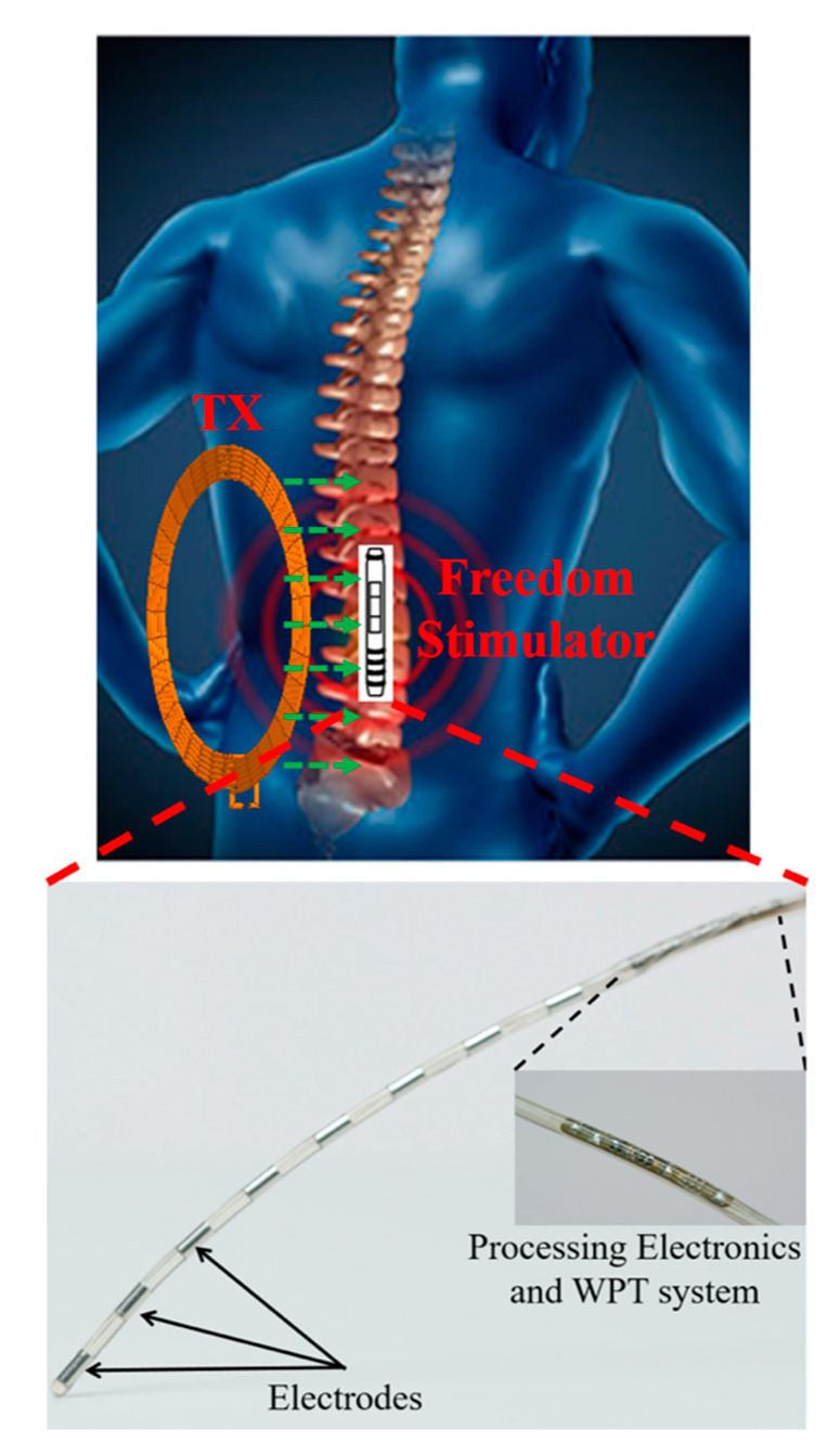 Figure 13