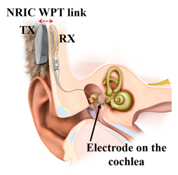 Figure 19