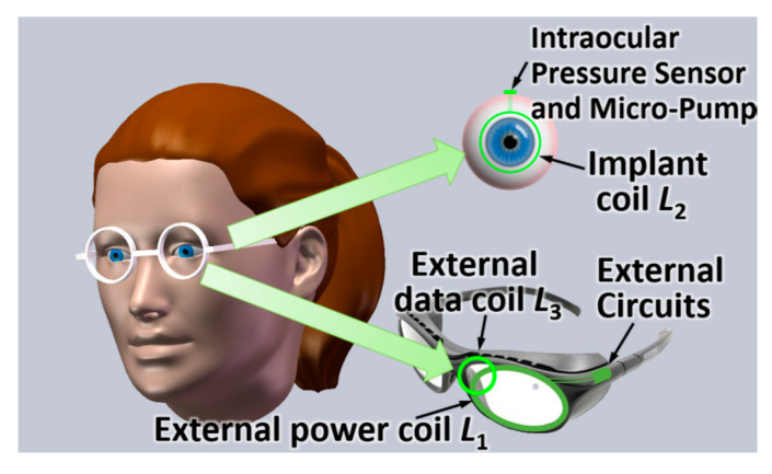 Figure 14