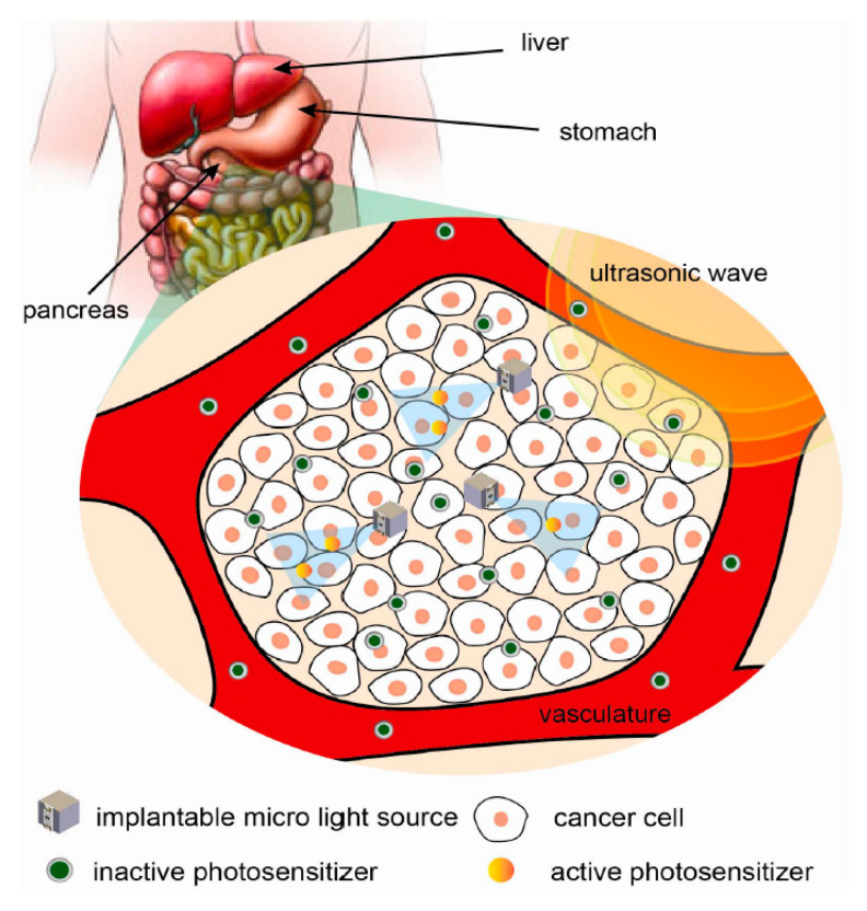 Figure 49