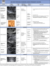 Pregnancy location. The location of a pregnancy is divided into
normal, abnormal, and unknown. Lexicon terms are bolded and/or italicized,
and terms to avoid are in single quotation marks. The essential word in the
definition of intrauterine pregnancy and ectopic pregnancy (EP) is
implanted, which helps differentiate pregnancies that are temporarily
located in the lower uterine segment. This definition also further clarifies
abnormal intrauterine implantation sites as EPs.