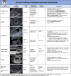 Early development. Lexicon terms (bolded and/or italicized) in this
table relate to structures visualized at US in early pregnancy development.
Terms to avoid are in single quotation marks. Terms specific to
multigestation pregnancies, such as chorionicity and amnionicity, are beyond
the scope of this lexicon.