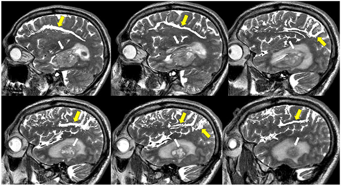 FIGURE 12