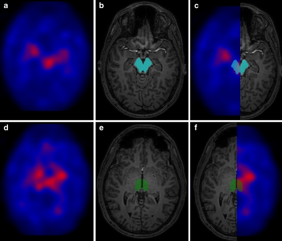 Fig. 1