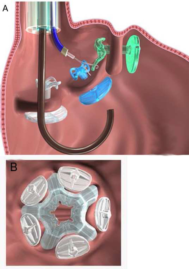 FIGURE 6