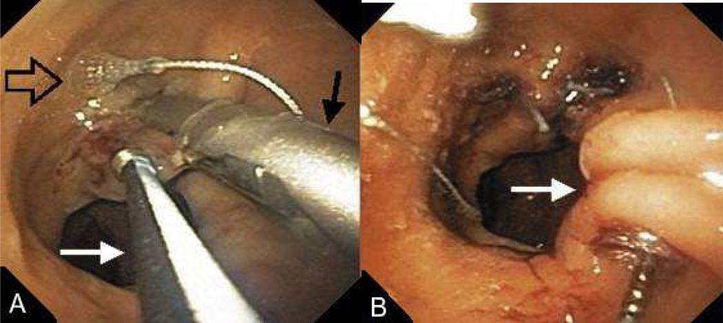 FIGURE 12