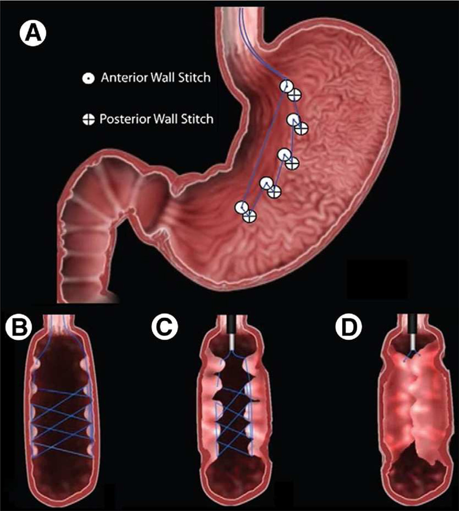 FIGURE 3