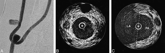 fig 5.