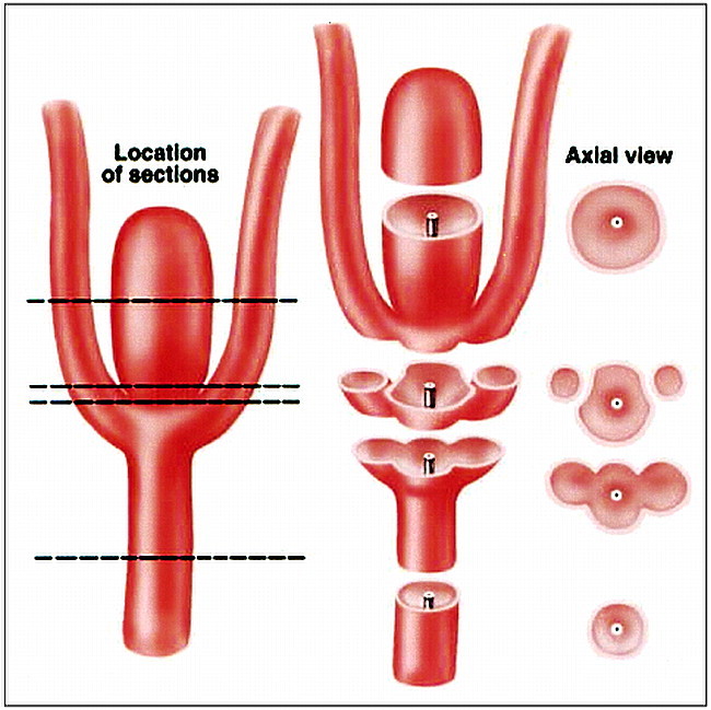 fig 4.