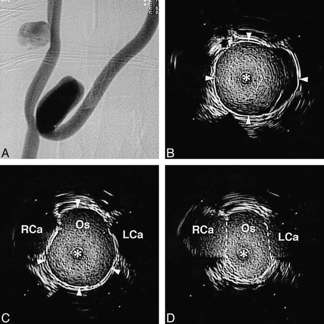 fig 7.