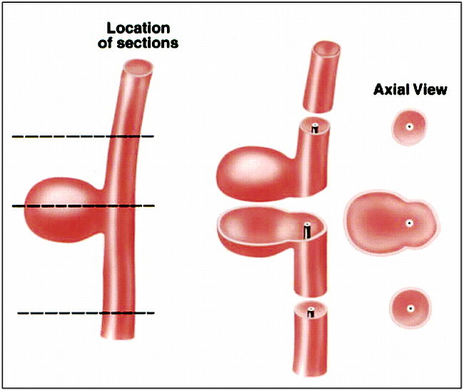 fig 3.