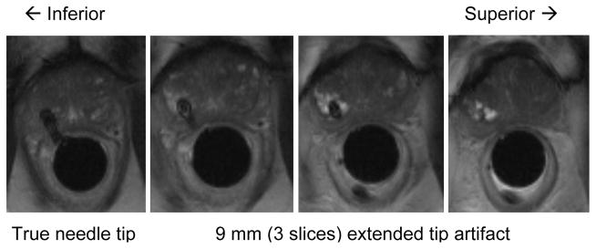 Fig. 10