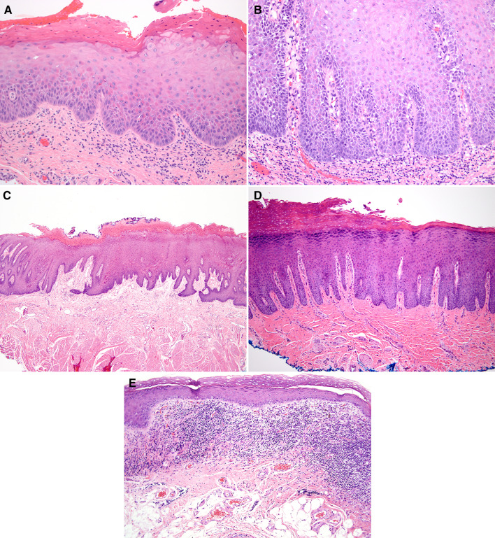 Fig. 13